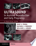 ULTRASOUND IN ASSISTED REPRODUCTION AND EARLY PREGNANCY. A PRACTICAL GUIDE