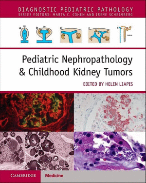 PEDIATRIC NEPHROPATHOLOGY & CHILDHOOD KIDNEY TUMORS WITH ONLINE RESOURCE