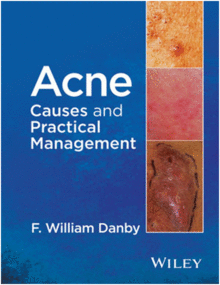 ACNE. CAUSES AND PRACTICAL MANAGEMENT
