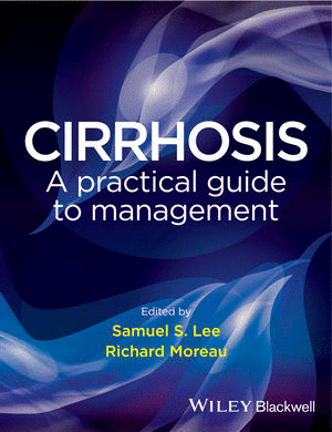 CIRRHOSIS. A PRACTICAL GUIDE TO MANAGEMENT