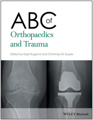 ABC OF ORTHOPAEDICS AND TRAUMA