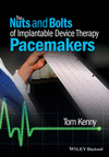 THE NUTS AND BOLTS OF IMPLANTABLE DEVICE THERAPY. PACEMAKERS