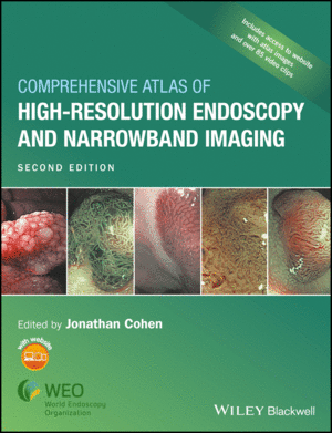 COMPREHENSIVE ATLAS OF HIGH-RESOLUTION ENDOSCOPY AND NARROWBAND IMAGING, 2ND EDITION
