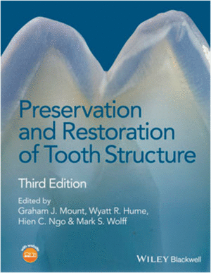PRESERVATION AND RESTORATION OF TOOTH STRUCTURE, 3RD EDITIO