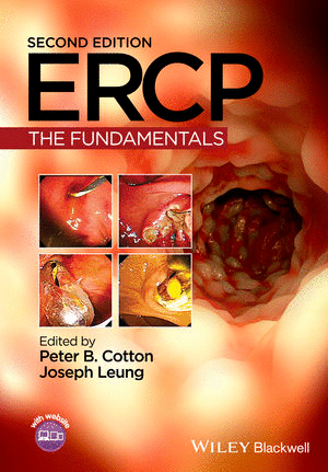 ERCP: THE FUNDAMENTALS