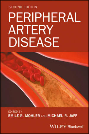 PERIPHERAL ARTERY DISEASE, 2ND EDITION