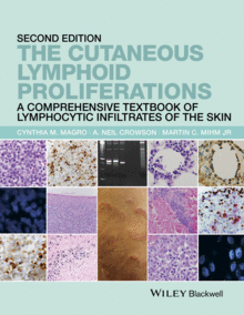 THE CUTANEOUS LYMPHOID PROLIFERATIONS. 2ND EDITION