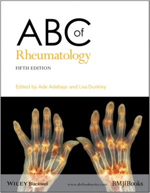 ABC OF RHEUMATOLOGY, 5TH EDITION
