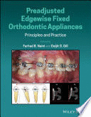 PREADJUSTED EDGEWISE FIXED ORTHODONTIC APPLIANCES. PRINCIPLES AND PRACTICE
