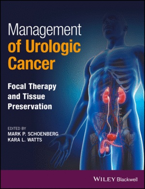 MANAGEMENT OF UROLOGIC CANCER: FOCAL THERAPY AND TISSUE PRESERVATION