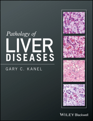 PATHOLOGY OF LIVER DISEASES