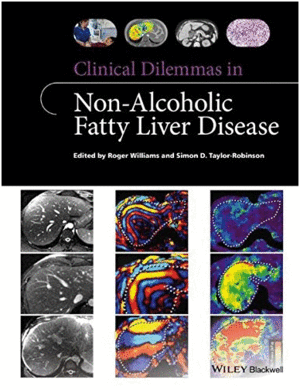 CLINICAL DILEMMAS IN NON-ALCOHOLIC FATTY LIVER DISEASE