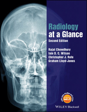 RADIOLOGY AT A GLANCE. 2ND EDITION