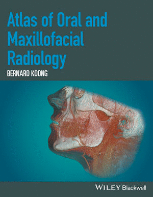 ATLAS OF ORAL AND MAXILLOFACIAL RADIOLOGY
