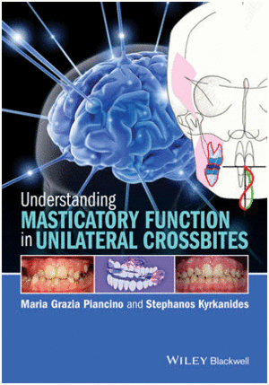 UNDERSTANDING MASTICATORY FUNCTION IN UNILATERAL CROSSBITES