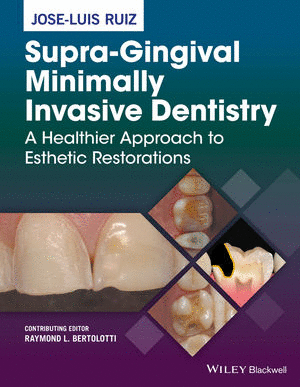 SUPRA-GINGIVAL MINIMALLY INVASIVE DENTISTRY: A HEALTHIER APPROACH TO ESTHETIC RESTORATIONS