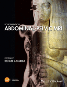 ABDOMINAL-PELVIC MRI, 4TH EDITION