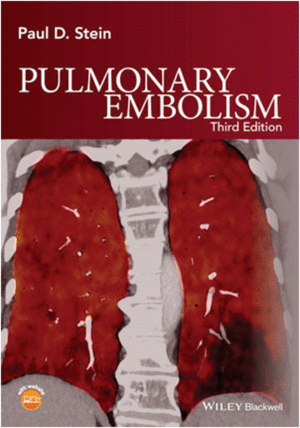 PULMONARY EMBOLISM. 3RD EDITION
