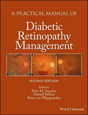 A PRACTICAL MANUAL OF DIABETIC RETINOPATHY MANAGEMENT. 2ND EDITION