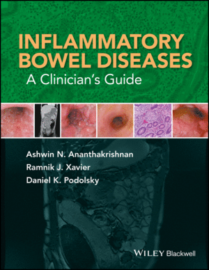 INFLAMMATORY BOWEL DISEASES: A CLINICIANS GUIDE