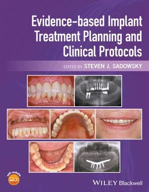 EVIDENCE-BASED IMPLANT TREATMENT PLANNING AND CLINICAL PROTOCOLS