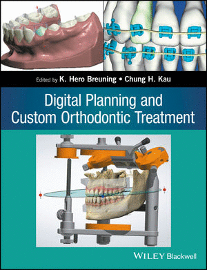 DIGITAL PLANNING AND CUSTOM ORTHODONTIC TREATMENT