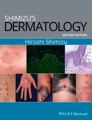SHIMIZU'S DERMATOLOGY, 2ND EDITION