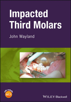 IMPACTED THIRD MOLARS