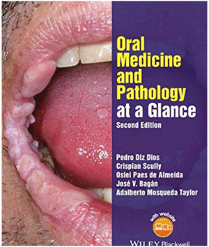 ORAL MEDICINE AND PATHOLOGY AT A GLANCE. 2ND EDITION