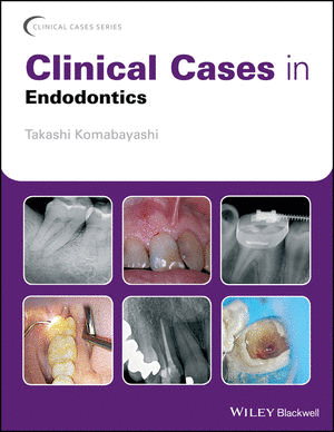 CLINICAL CASES IN ENDODONTICS