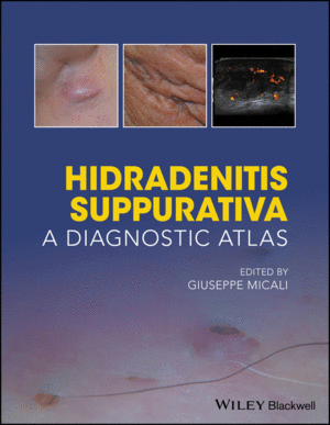 HIDRADENITIS SUPPURATIVA: A DIAGNOSTIC ATLAS