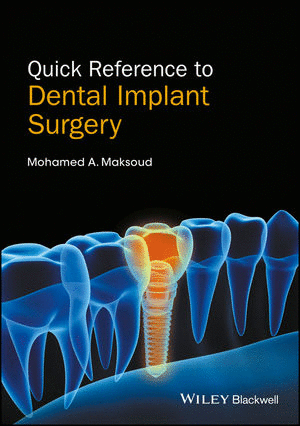 QUICK REFERENCE TO DENTAL IMPLANT SURGERY