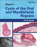 SHEAR'S CYSTS OF THE ORAL AND MAXILLOFACIAL REGIONS. 5TH EDITION
