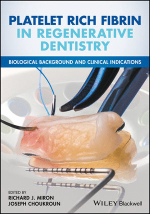 PLATELET RICH FIBRIN IN REGENERATIVE DENTISTRY. BIOLOGICAL BACKGROUND AND CLINICAL INDICATIONS