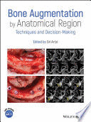 BONE AUGMENTATION BY ANATOMICAL REGION. TECHNIQUES AND DECISION-MAKING