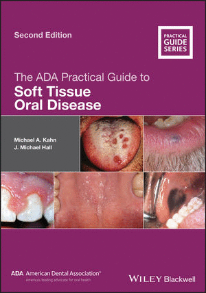 THE ADA PRACTICAL GUIDE TO SOFT TISSUE ORAL DISEASE. 2ND EDITION