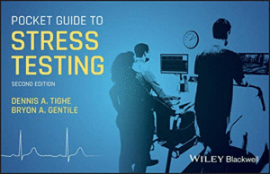 POCKET GUIDE TO STRESS TESTING, 2ND EDITION