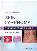 SKIN LYMPHOMA. THE ILLUSTRATED GUIDE. 5TH EDITION