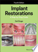 IMPLANT RESTORATIONS. A STEP-BY-STEP GUIDE. 4TH EDITION