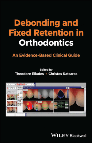 DEBONDING AND FIXED RETENTION IN ORTHODONTICS. AN EVIDENCE-BASED CLINICAL GUIDE