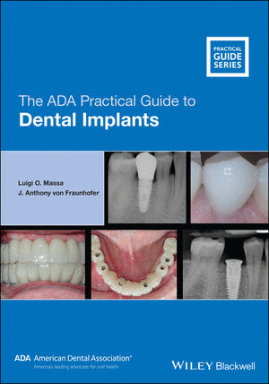 THE ADA PRACTICAL GUIDE TO DENTAL IMPLANTS