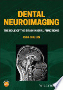 DENTAL NEUROIMAGING. THE ROLE OF THE BRAIN IN ORAL FUNCTIONS