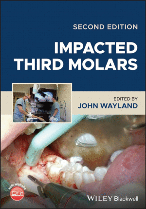 IMPACTED THIRD MOLARS. 2ND EDITION