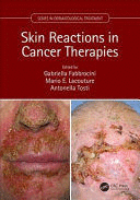 DERMATOLOGIC REACTIONS TO CANCER THERAPIES