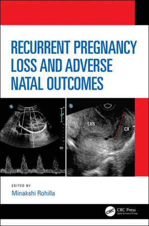 RECURRENT PREGNANCY LOSS AND ADVERSE NATAL OUTCOMES