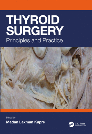 THYROID SURGERY. PRINCIPLES AND PRACTICE