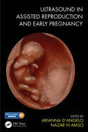 ULTRASOUND IN ASSISTED REPRODUCTION AND EARLY PREGNANCY