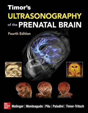 TIMOR`S ULTRASONOGRAPHY OF THE PRENATAL BRAIN. 4TH EDITION
