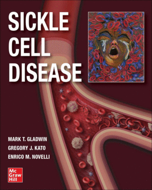 SICKLE CELL DISEASE