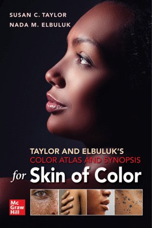 TAYLOR AND ELBULUK'S COLOR ATLAS AND SYNOPSIS FOR SKIN OF COLOR